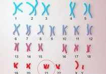 yq号染色体是什么意思 性染色体为xxy的男性正常吗