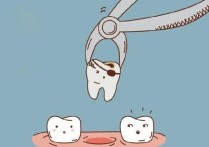 304牙科怎么收费 正规医院拔牙贵还是外面的牙科贵